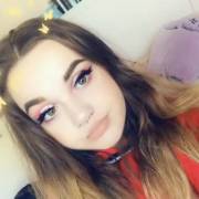 Me After My Braces Were About To Be Taken Off :) Figured Someone Should Enjoy This! ...