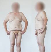 M/48/5'9&Amp;Quot; : Sw=305Lbs. Cw=190Lbs After 18 Months. Gw Is 160Lbs. Working ...