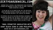 Anal Sphincter Anihilation With Giant Black Dong &Amp;Amp;Amp; Long Prolapse