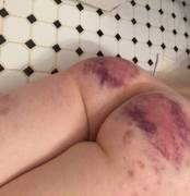 [F 21] First Time With Impact Play