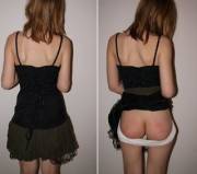 Before &Amp;Amp;Amp; After