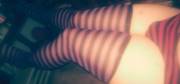 Stripes Are Super Fun Yo! Shimapan And Stockings Represent!