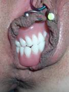 Dentures?  Sure, Why Not!  (Cross-Post From Wtf)