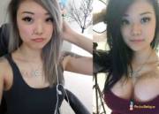 Asian Girl Buys New Boobs!:)