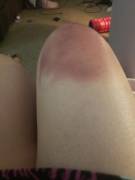 Got New Toys In. Got Carried Away With Testing Them Out On Myself. Can't Wait For ...