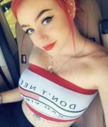 The Sun Sure Seems To Bring Out These Freckles