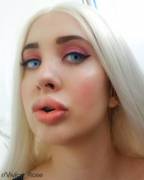 Went For 2Ml At A Time. Still Super Swollen (Oc)