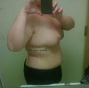 Horny (F)Rom The Hospital - Album On Imgur