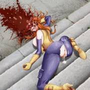 &Amp;Quot;She Uh... Fell Down Some Stairs&Amp;Quot;