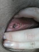 This Is What A 20 Year Old Hymen Looks Like! And Pictures Of My Body.