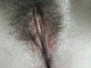 20F. More Hymen Pictures While On My Period. Contracted Vs Relaxed Pelvic Floor Muscles.