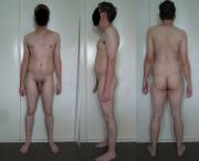 31/M. 171Cm/5'7&Amp;Quot;. 62Kg/136Lbs. Minor Scoliosis &Amp;Amp;Amp; My Penis Likes ...