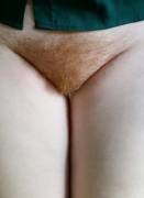 Yes, The Curtains Match The Drapes. [F]