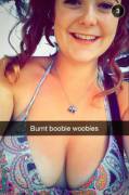 [Sc] Burnt Boobie Woobies