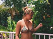 I Improved On An Existing X-Ray. Nothing Was Added, All Came From The Same Image. ...