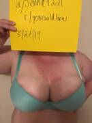 Super Sunburned Verification Post!