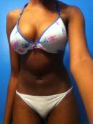 Are Self Shots Welcome?