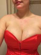 Post Sex. The Red Marks Are From My Husband Biting Me ;)