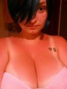 Sorry I've Been Gone So Long Guys, Hope This Picture Of My Sunburn Makes Up For It ...