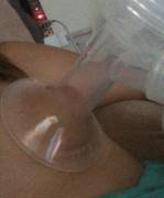 I've Been Pumping And Partner Suckling To Induce Lactation But Not Quite Milking ...