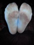 Softball Socks Up For Grabs 2 Colors Blue And Pink Extremely Stinky! &Amp;#3616 Shipped ...