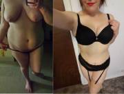 32/F/146/5'5&Amp;Quot; I Lost 75 Pounds And Some Breast Meat. Hopefully It Was All ...