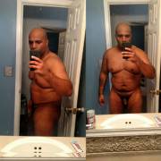 M/33/224/5'9 Down 17Lbs In 30 Day. I Was Hospitalized For Three Weeks And Partially ...