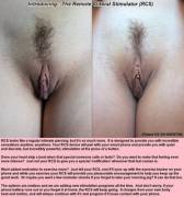 Remote Clitoral Stimulator (7 Images) [Piercing] [Teasing] [Forced Orgasm]