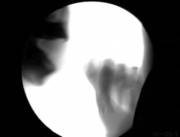 Fluoroscope Fellatio (X-Post R/Interestingasfuck)