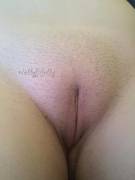 Sel(F) Posts Allowed?