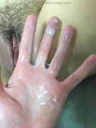 Hand Covered In Grool - Album On Imgur