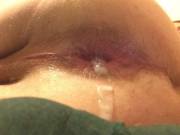 Freshly Fucked Asshole