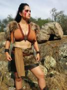 Gf Is Getting A Breast Reduction Today. Let Us Know How Much You Love Her G Cups!