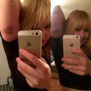 I Got An Owie, So What Do You Do?.... Put An Unnecessary Band-Aid Over It! All Better!