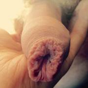 Boyfriend Was Walking Around With His Foreskin Puckered Ever So Perfectly