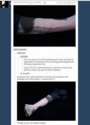 X-Post From R/Tumblr