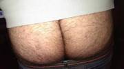 My Butt Is Rather Hairy