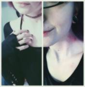 Found This While Browsing Through Old Photos. Not A Hickey... It's A Bruise From ...