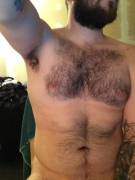 Feels Good To Have Hair