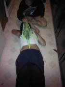 &Amp;Quot;Ready For Anything&Amp;Quot; Atomic Wedgie