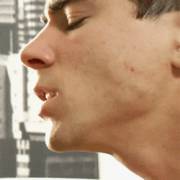 When You're Cutting Lemons And It Squirts In Your Eye