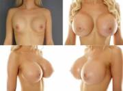 Room For Improvement!