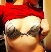 Til That Only Males Have A Muscle Called &Amp;Quot;Cremaster,&Amp;Quot; Which Elevates ...