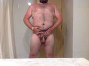 Big Britsh Bear Got Burnt On Holiday :(