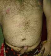 Should I Post My Whole Face?