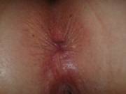 Closeup Asshole! Hot Or Not?