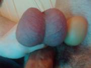 Massive Balls Vs. Egg