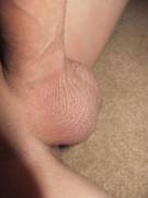 Almost Hairless Balls