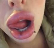 Alexia Licking Her Injected Lips!