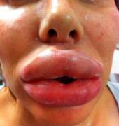 Fresh From The Doctors Office!